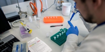 Η Covid-19 συνδέεται με αυξημένο κίνδυνο για αυτοάνοσα φλεγμονώδη ρευματικά νοσήματα