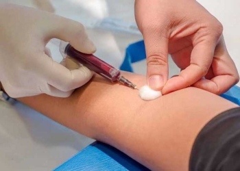 Εξέταση αίματος μπορεί να προβλέψει το Πάρκινσον επτά χρόνια πριν τα συμπτώματα