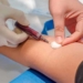 Εξέταση αίματος μπορεί να προβλέψει το Πάρκινσον επτά χρόνια πριν τα συμπτώματα