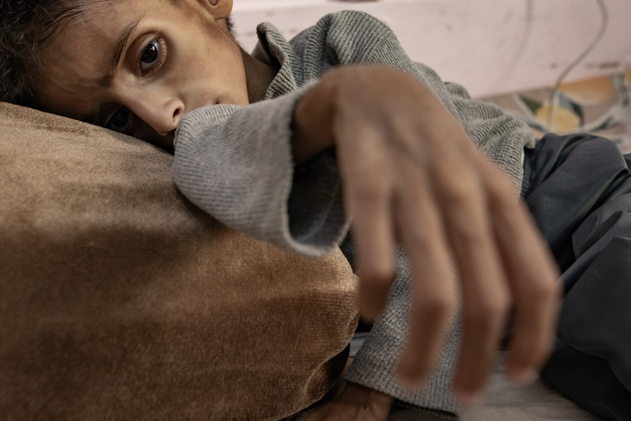 epaselect epa12137107 Five-year-old Palestinian child Osama al-Raqab, who is suffering from severe malnutrition receives treatment at Nasser Hospital in Khan Yunis, southern Gaza Strip, 26 May 2025. EPA/HAITHAM IMAD